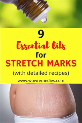 Prevent Stretch Mark Cream