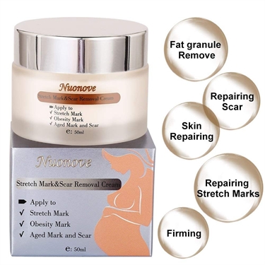 Best Cream For Pregnancy To Prevent Stretch Marks