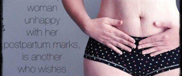 Pregnancy Stretch Marks Cream During Pregnancy