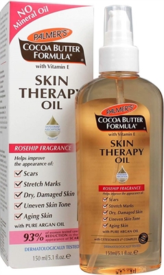 How Can I Prevent Stretch Marks