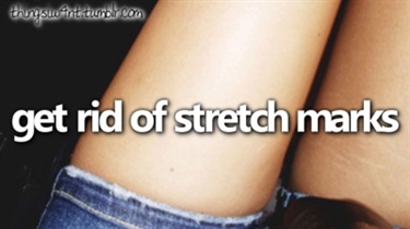 What Removes Stretch Marks Quickly