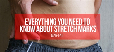 How To Prevent Getting Stretch Marks During Pregnancy