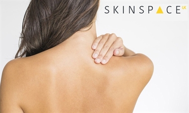 Living With Stretch Marks