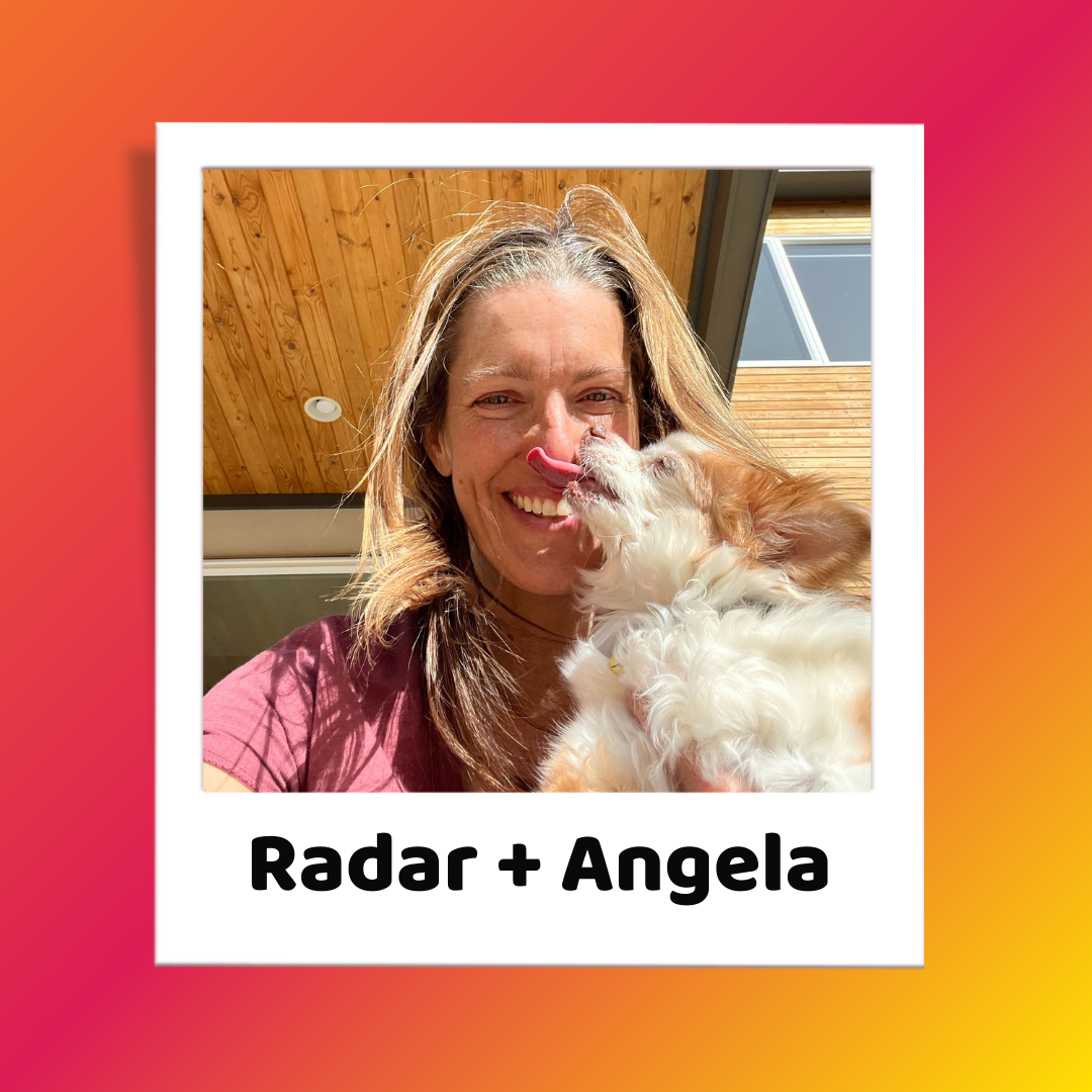 Radar