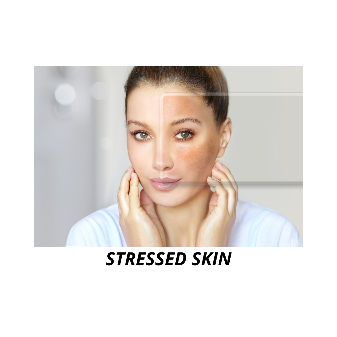How Stress Manifests on Your Skin (And What to Do About It)