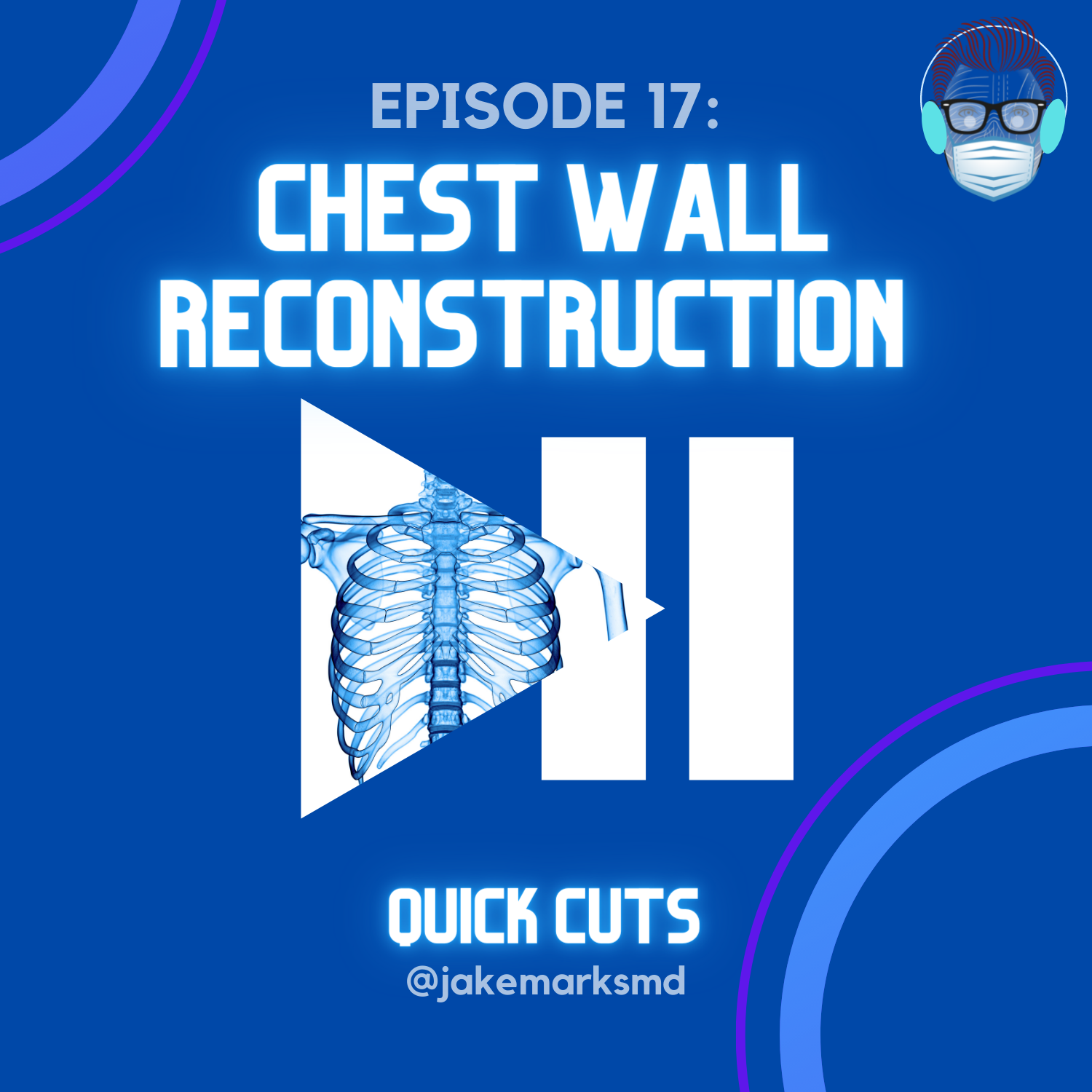 Episode 17 Chest Wall Reconstruction Quick Cuts A Plastic Surgery