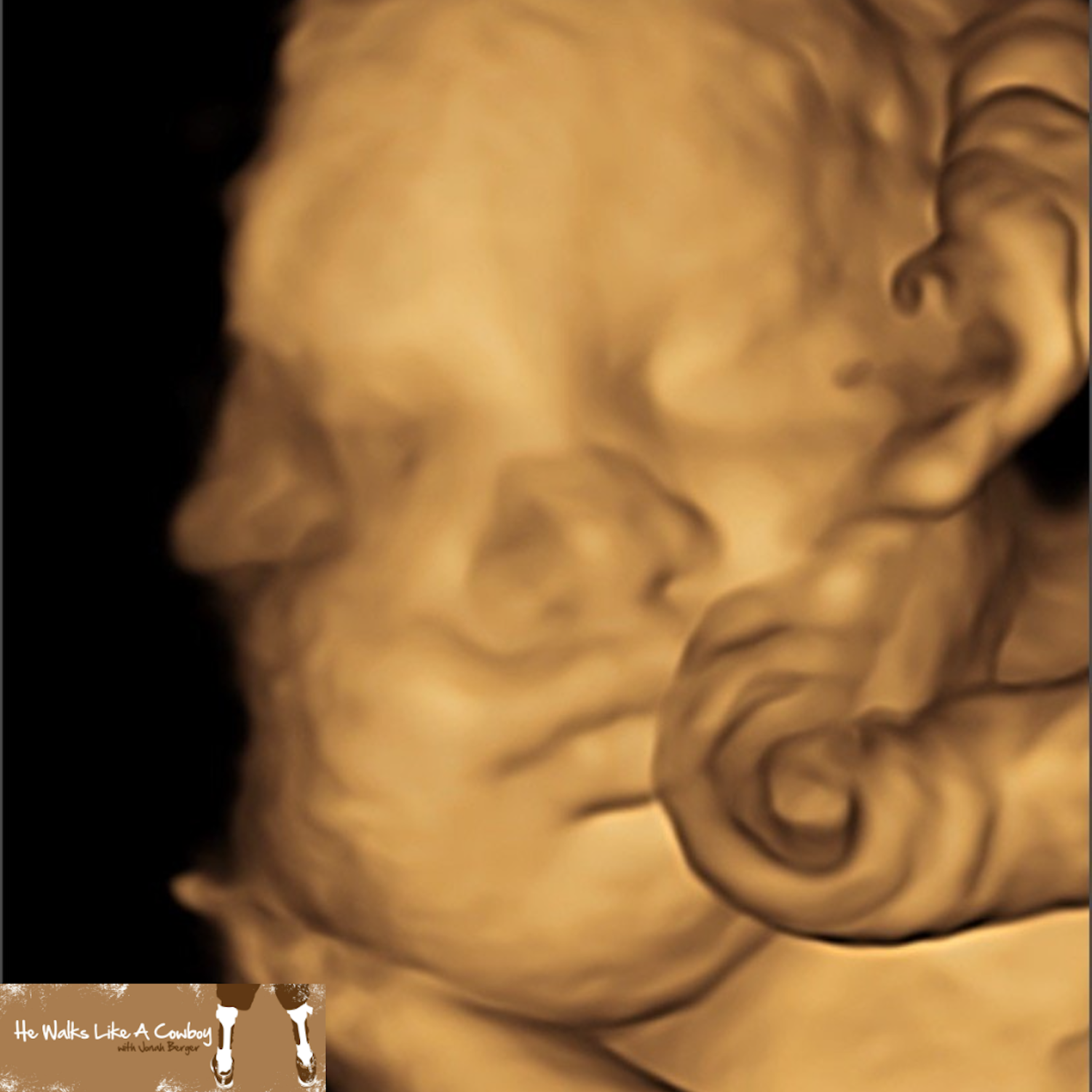 042 - Anything but Down