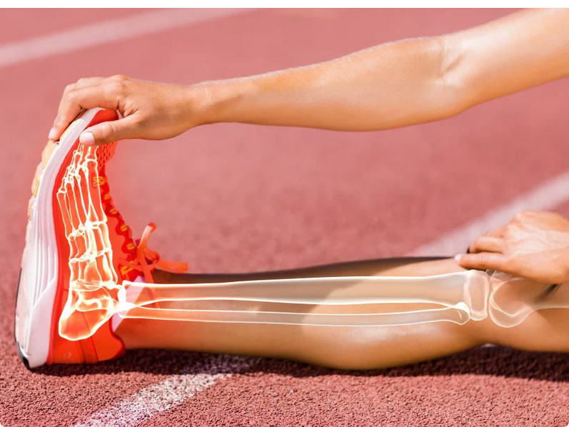 GLP-1 Drugs Linked with Bone Loss, Softer Bones and Gout