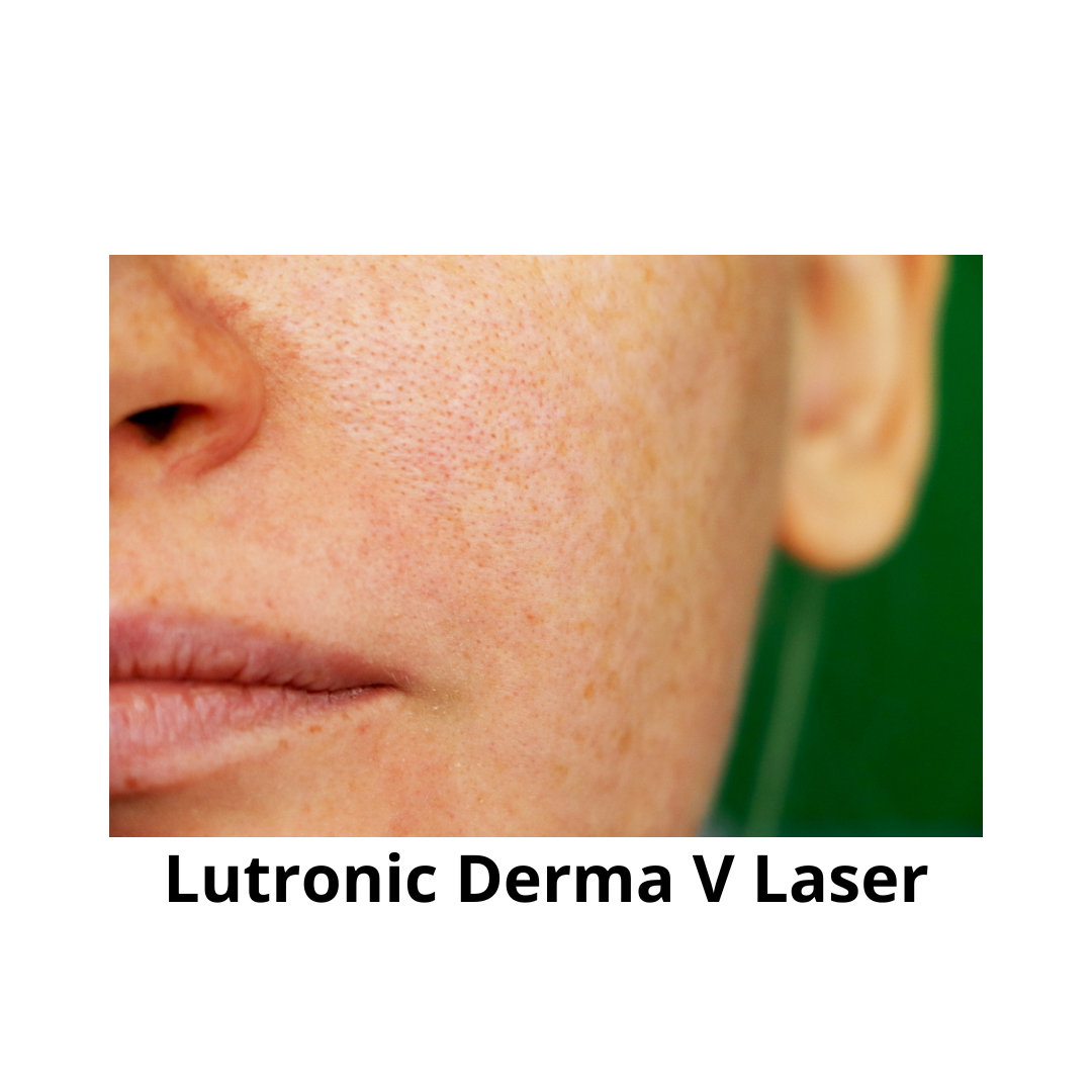 Lutronic Derma V Laser Explained: Uses, Technology & Clinical Insight with Dr. James Wang
