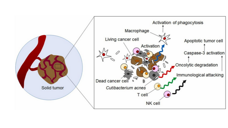 Scientists Discover Common Bacteria Cures 100% of Colon Cancer in Experiment