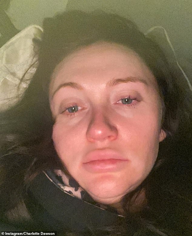 Valiente: Charlotte Dawson ha revelado que se siente 'petrificada y agotada' mientras lucha contra la diabetes gestacional durante su embarazo