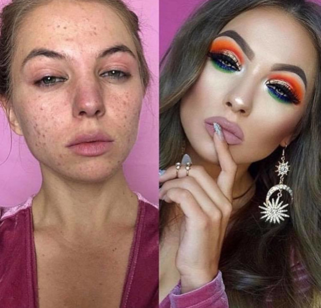 acne coverage beauty transformations