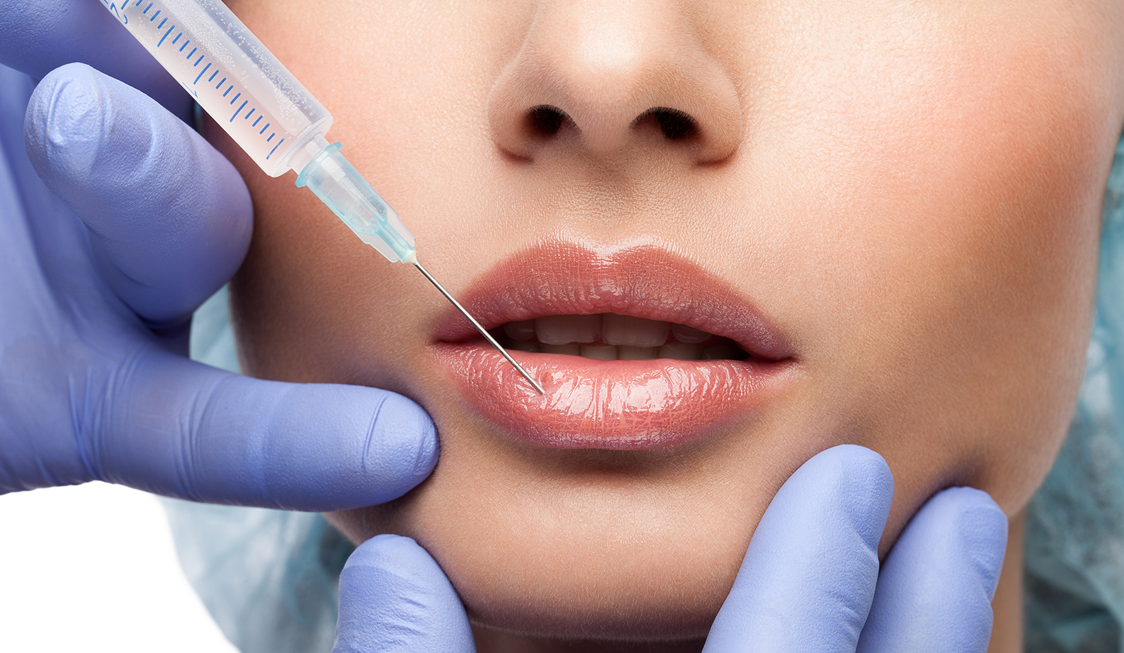 pros-and-cons-of-lip-filler-woman-getting-injection