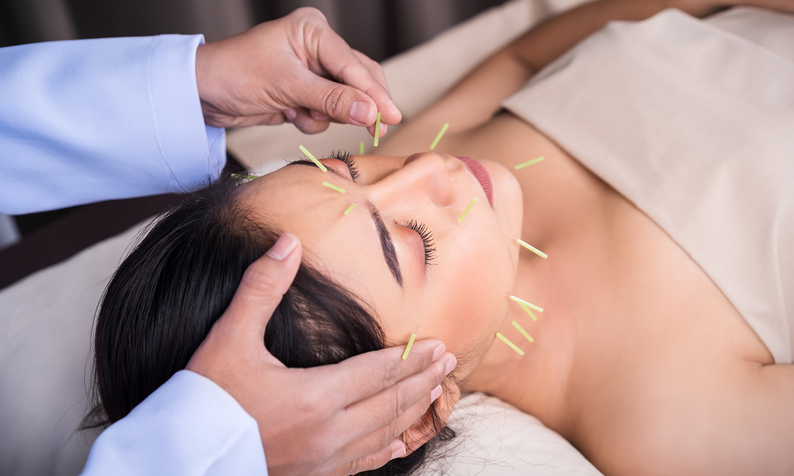 facial-acupuncture-someone-putting-needles-in-patients-face